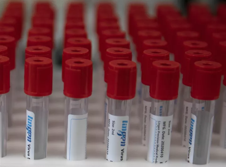 CEPI: Ενίσχυση 66 εκατ. δολαρίων στην Clover για τις δοκιμές εμβολίου κατά της Covid-19